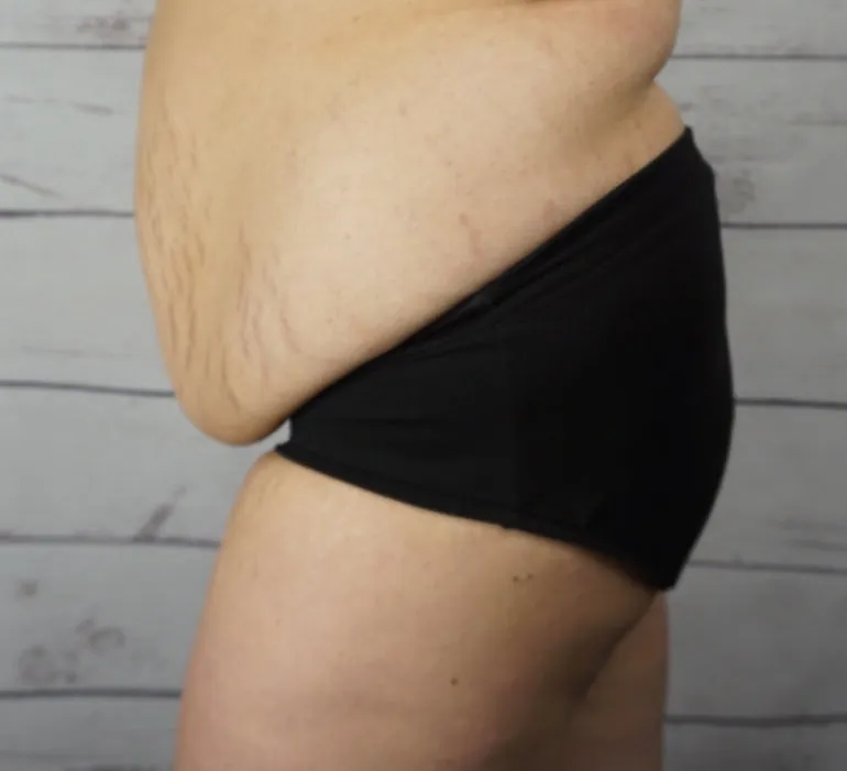 MyFit Underwear
