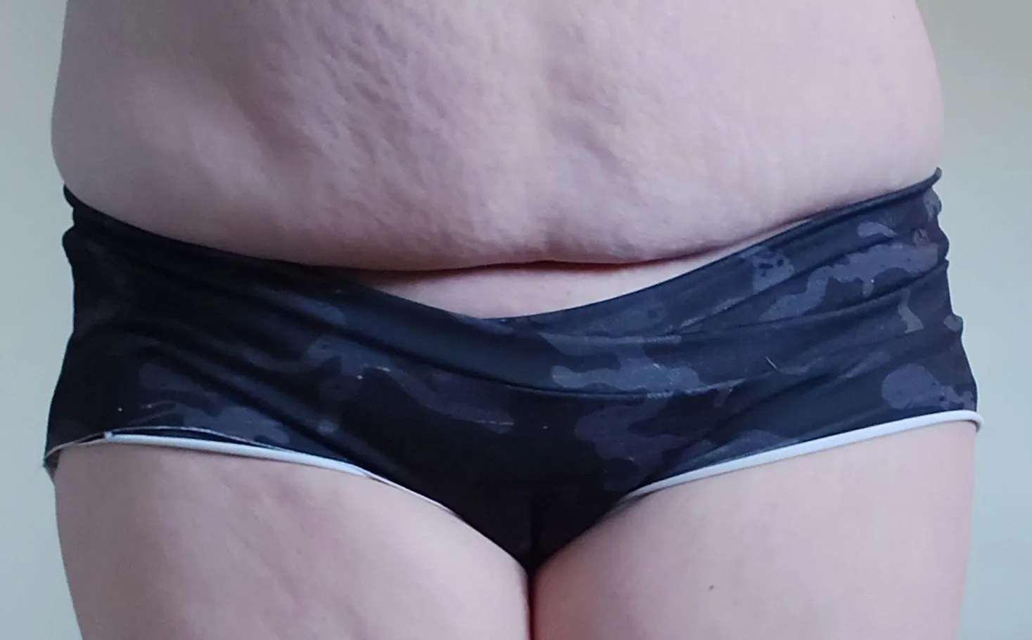 MyFit Underwear